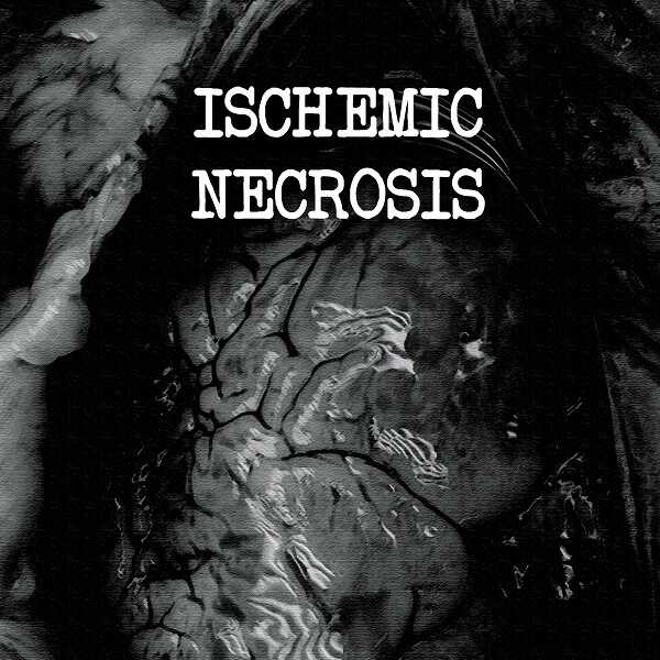 ISCHEMIC NECROSIS - Nauseating Stew of Rancid Decomposition CD